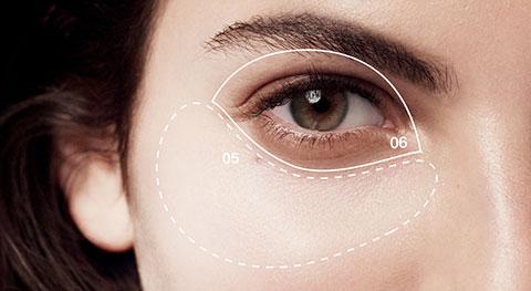 Dark Circles Under the Eyes: Causes and Treatments