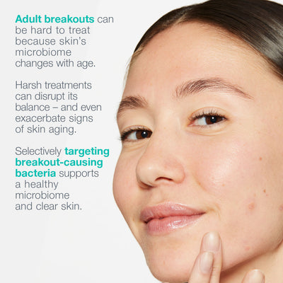 dermalogica moisturisers 50ml breakout biotic moisturizer