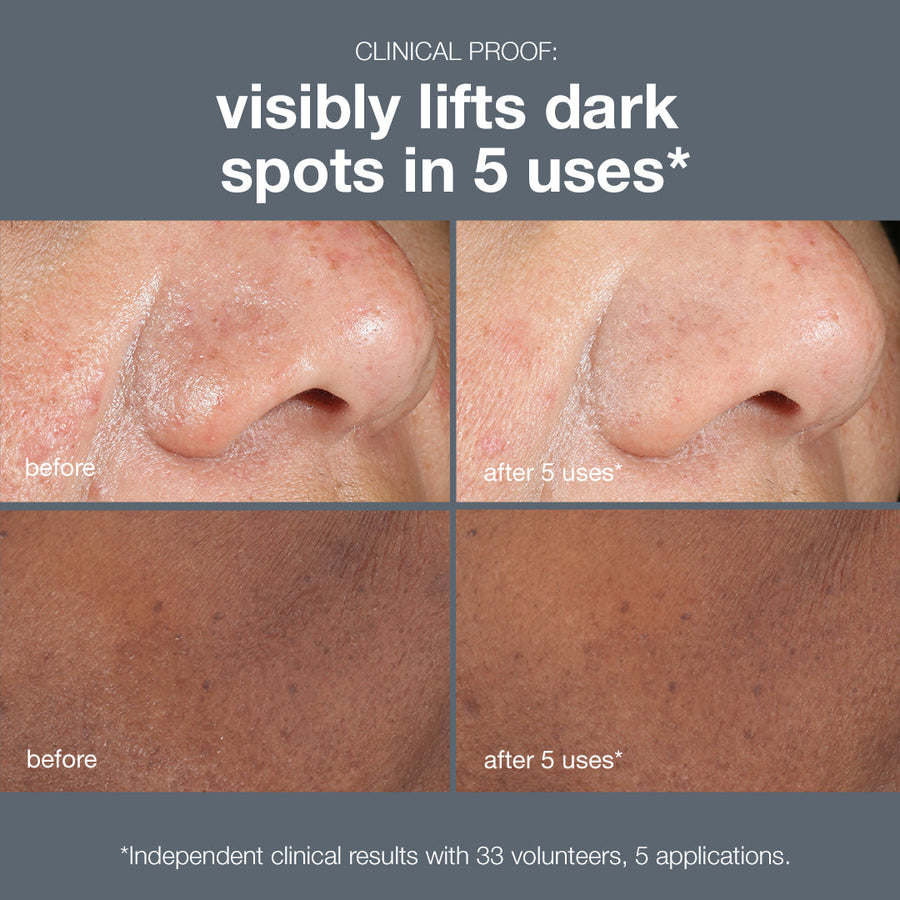 dermalogica powerbright dark spot peel
