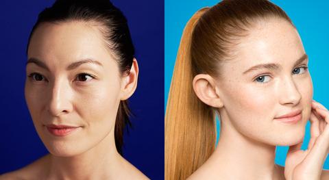adult acne vs. teen acne: what's the difference?
