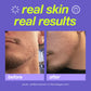 dermalogica cleansers breakout clearing foaming wash