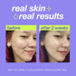 dermalogica concentrated boosters 30ml breakout clearing booster