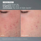 dermalogica exfoliants daily microfoliant