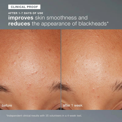 dermalogica exfoliants daily microfoliant