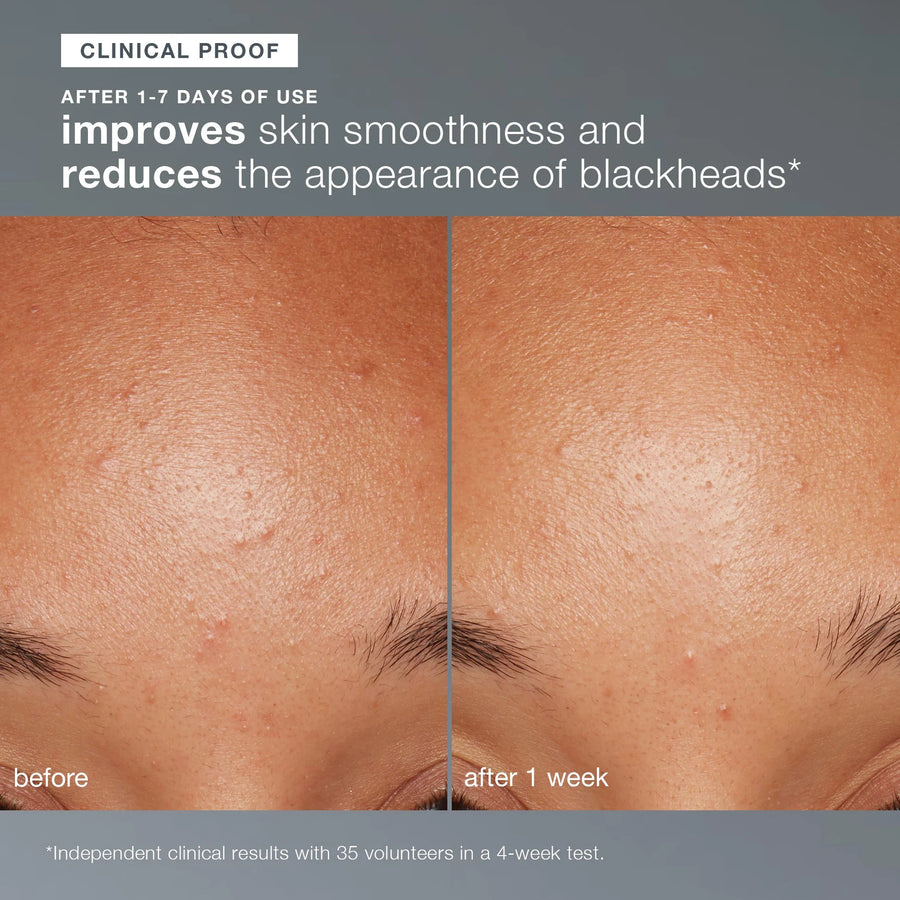 dermalogica exfoliants daily microfoliant
