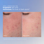 dermalogica exfoliants daily microfoliant exfoliator