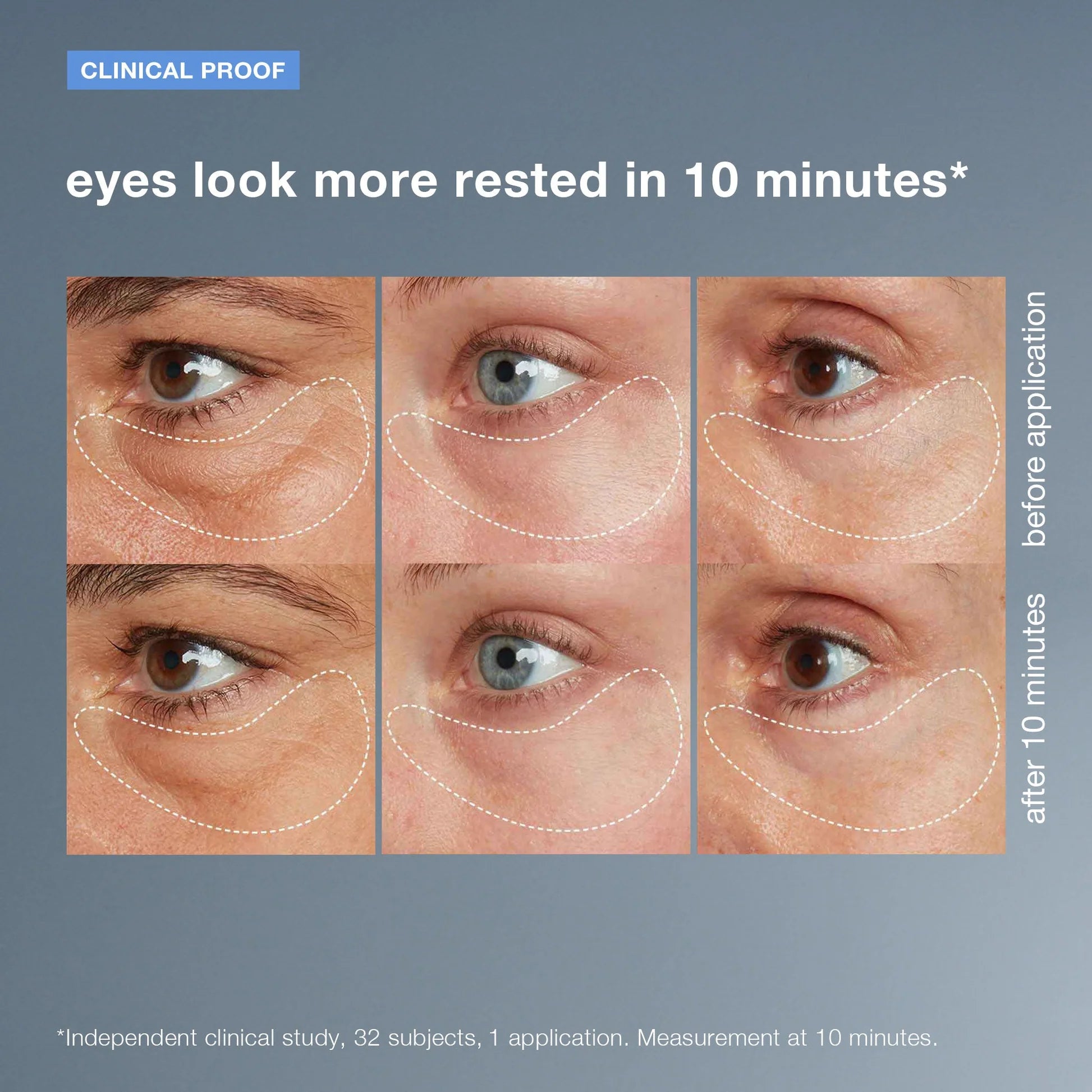 dermalogica eye treatments 15ml awaken peptide depuffing eye gel