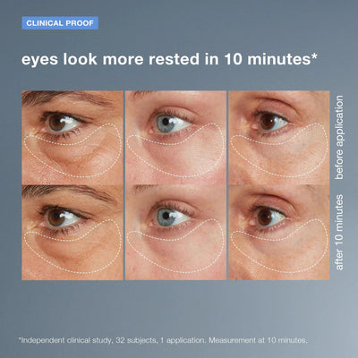 dermalogica eye treatments 15ml awaken peptide depuffing eye gel