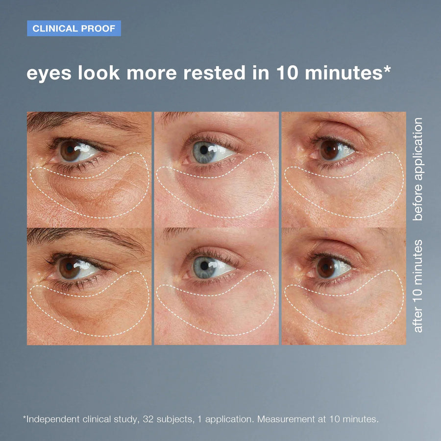 dermalogica eye treatments 15ml awaken peptide depuffing eye gel