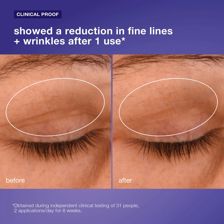 dermalogica eye treatments 15ml phyto nature lifting eye cream