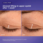 dermalogica eye treatments 15ml phyto nature lifting eye cream
