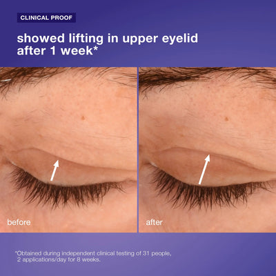 dermalogica eye treatments 15ml phyto nature lifting eye cream