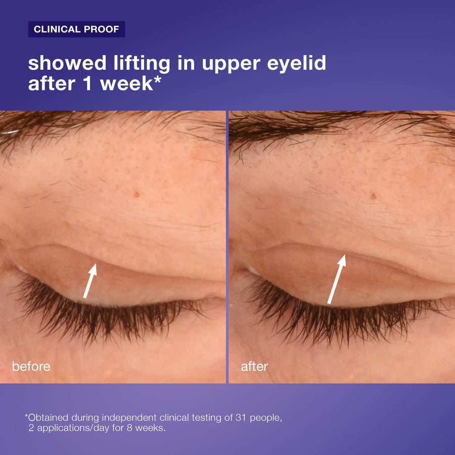 dermalogica eye treatments 15ml phyto nature lifting eye cream