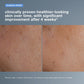 dermalogica facial oils and serums smart response serum