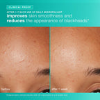 dermalogica skin kits and sets kit clear and brighten kit