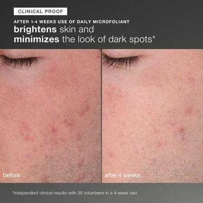 dermalogica skin kits and sets kit discover healthy skin kit