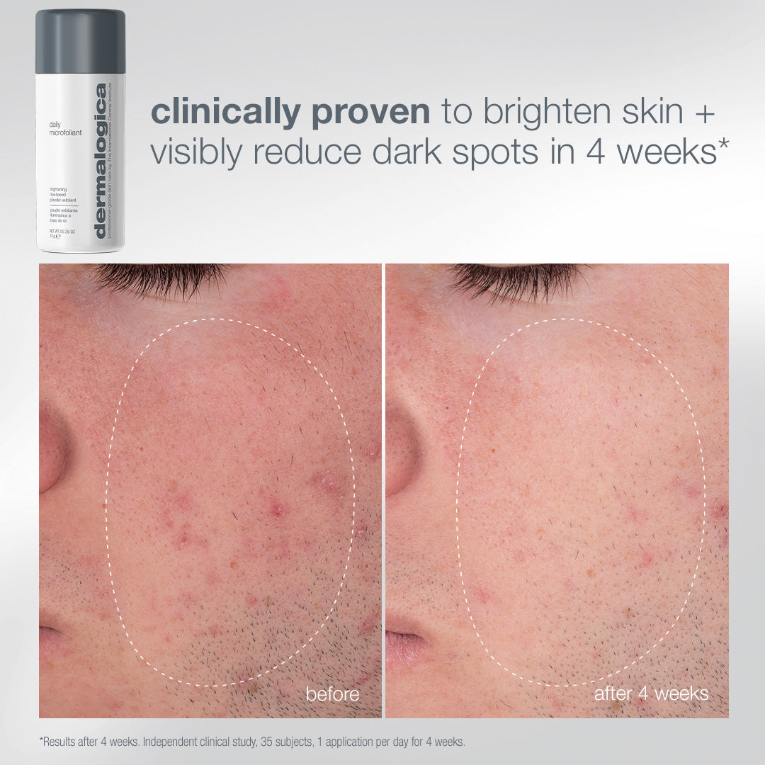dermalogica skin kits and sets kit expert cleanse + glow kit