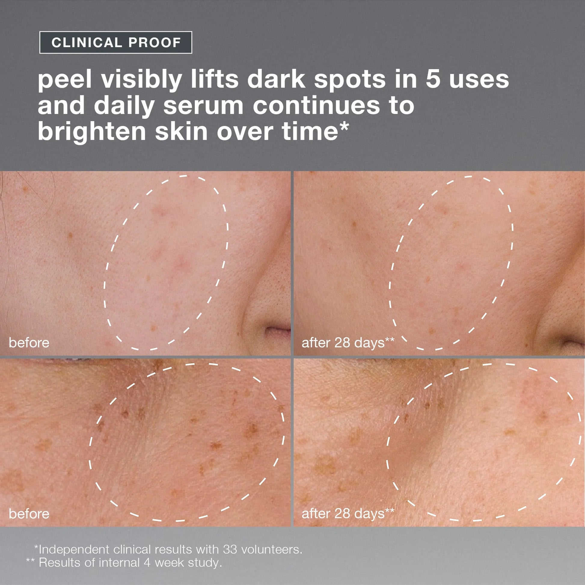 dermalogica skin kits and sets kit powerbright dark spot system