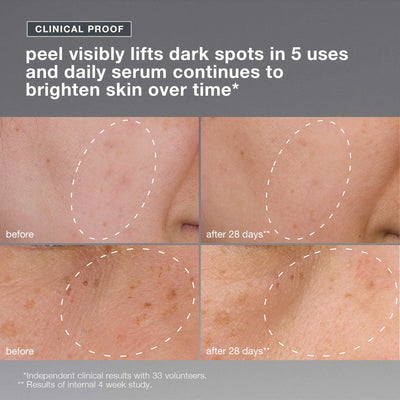 dermalogica skin kits and sets kit powerbright dark spot system