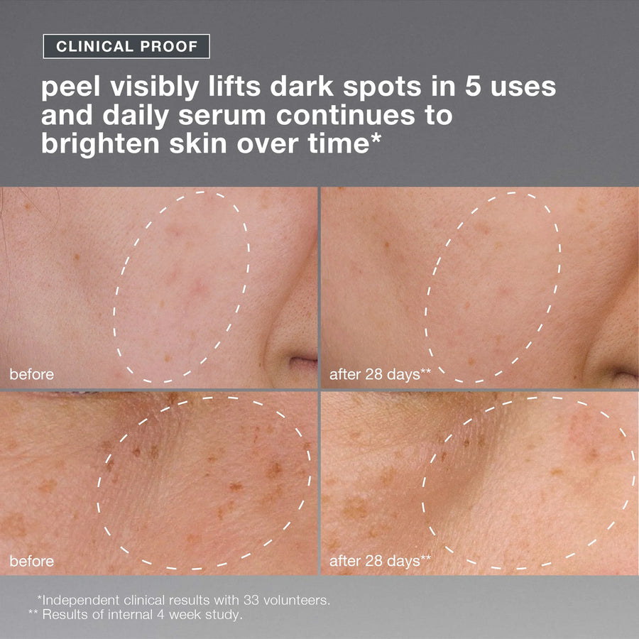 dermalogica skin kits and sets kit powerbright dark spot system