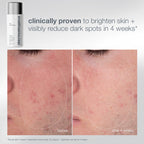 dermalogica skin kits and sets kit pro ritual: exfoliate + glow kit