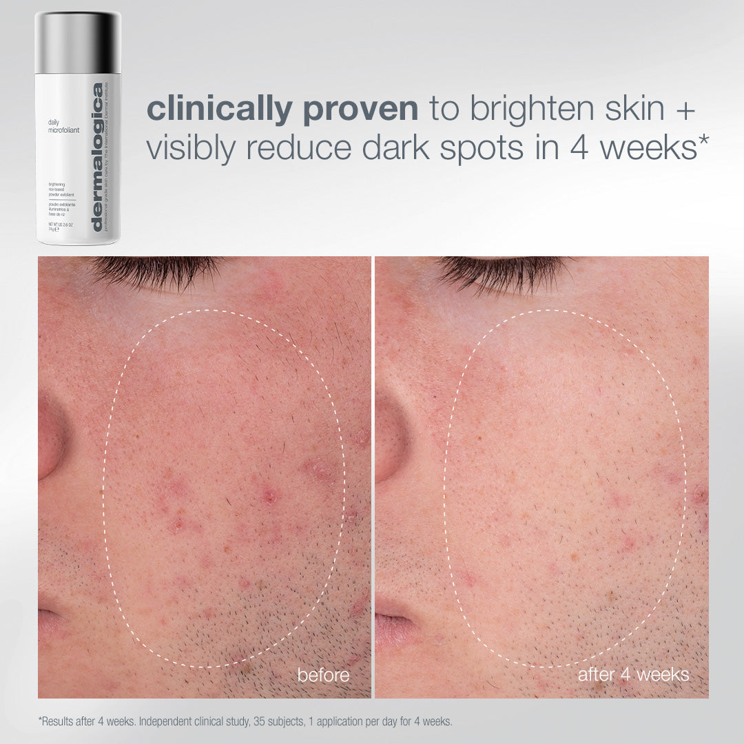 dermalogica skin kits and sets kit pro ritual: exfoliate + glow kit
