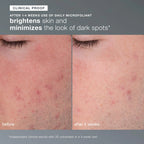 dermalogica skin kits and sets kit skin transformation duo
