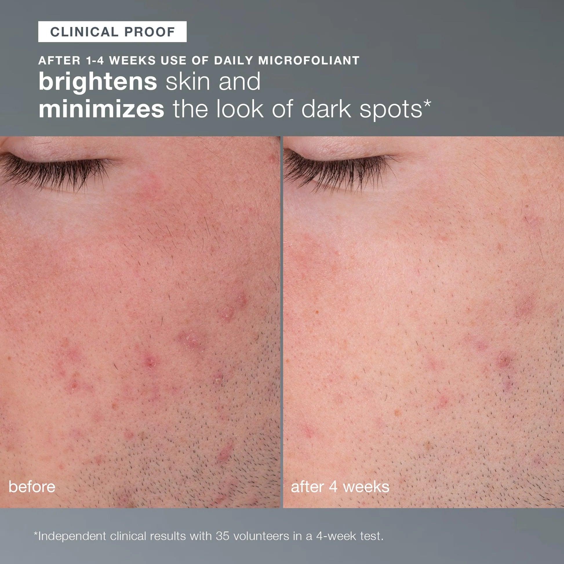 dermalogica skin kits and sets kit skin transformation duo