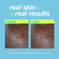 dermalogica targeted treatments 15ml post-breakout fix spot treatment